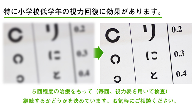 小学生の視力回復に鍼灸治療